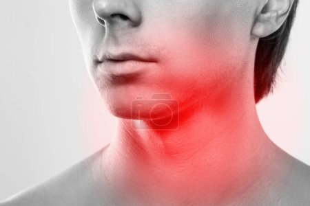 Photo for Male face with a painful red spot on the neck. Concepts of problems with thyroid or sore throat. - Royalty Free Image