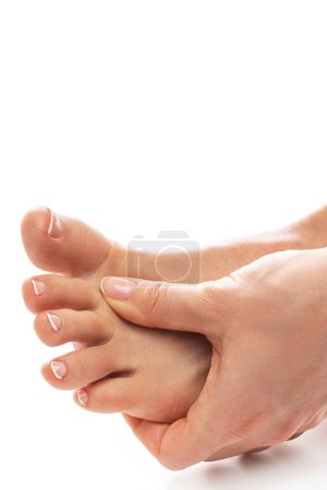 Photo for Closeup of female feet with itchy skin affected by fungal infection - Royalty Free Image