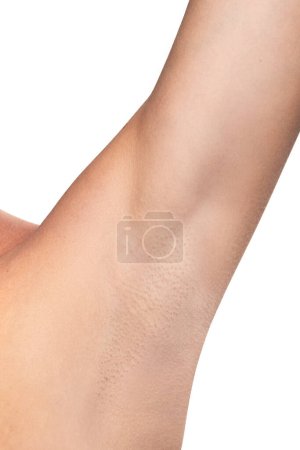 Photo for Closeup of female armpit on white background. Concept of hygiene and hair removal. - Royalty Free Image