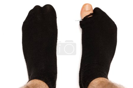Téléchargez les photos : Gros plan des pieds mâles dans de vieilles chaussettes hoaly avec un orteil se détachant sur fond blanc. Concept de pauvreté et de crise financière. - en image libre de droit