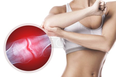 Photo for Female elbow and and X-ray effect with an injured joint - Royalty Free Image