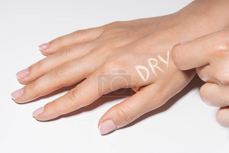 Téléchargez les photos : Gros plan de mains féminines avec peau qui démange et lettrage sec dessus - en image libre de droit