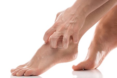 Foto de Primer plano de las piernas femeninas con piel seca con picor sobre fondo blanco - Imagen libre de derechos