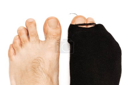 Foto de Primer plano de los pies masculinos con un dedo del pie sobresaliendo de un solo calcetín negro ronca sobre fondo blanco. Concepto de pobreza y crisis financiera. - Imagen libre de derechos