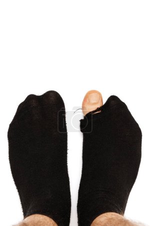 Foto de Primer plano de los pies masculinos en calcetines viejos hoaly con un dedo del pie sobresaliendo sobre fondo blanco. Concepto de pobreza y crisis financiera. - Imagen libre de derechos