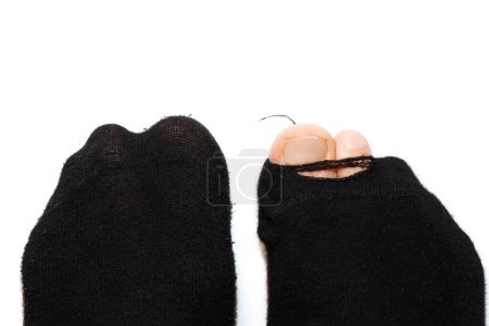 Photo for Closeup shot of male feet in old hoaly socks with a toes sticking out on white background. Concept of poverty and financial crisis. - Royalty Free Image