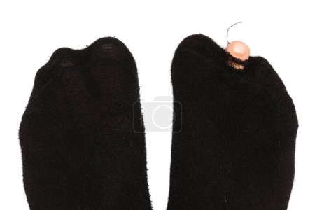 Foto de Primer plano de los pies masculinos en calcetines viejos hoaly con un dedo del pie sobresaliendo sobre fondo blanco. Concepto de pobreza y crisis financiera. - Imagen libre de derechos