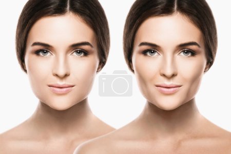 Comparación de la cara femenina después de una cirugía plástica exitosa de extracción de grasa bucal