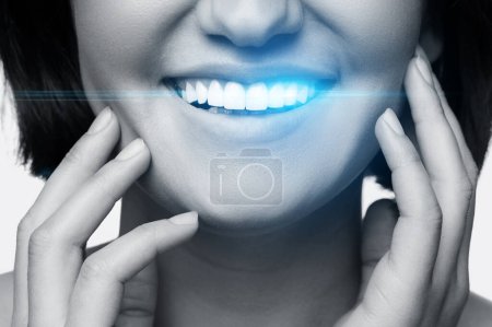 Photo for Smiling woman with shining white teeth after tooth whitening treatment. - Royalty Free Image