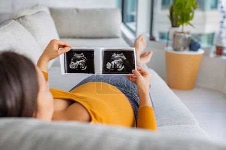 Ultraschall zeigt Fötus. Schwangerschaftskonzept mit schwangerer Frau, die das erste Foto ihres Babys betrachtet und glücklich die Geburt ihres ersten Kindes erwartet. Schwangerschaft im ersten Trimester.