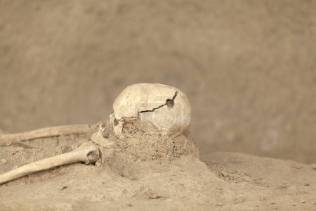 Téléchargez les photos : Squelette romain avec trou de bavure de crâne d'intervention chirurgicale trepanned - en image libre de droit