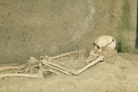 Téléchargez les photos : Squelette romain avec trou de bavure de crâne d'intervention chirurgicale trepanned - en image libre de droit