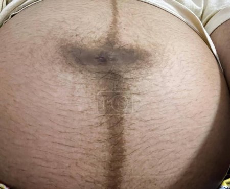 Téléchargez les photos : Une photographie d'une personne avec un ventre poilu et une croix sur le ventre. - en image libre de droit