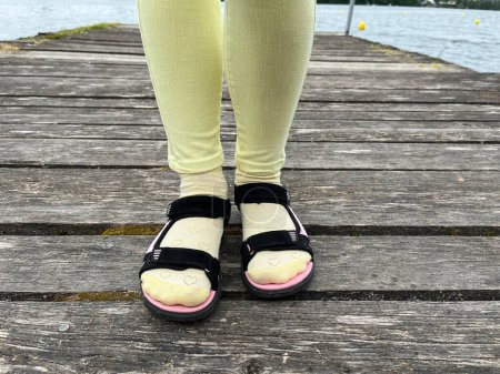 Black sandals on the girl's feet.