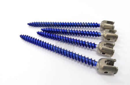 Photo for Closeup Image Of Blue Pedicle Screws for Spine Fusion Surgery - Royalty Free Image