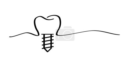 Illustration for Dental implant, medically accurate or dental bridge. Cartoon healthy, tooth with gums. Molar line pattern. Drawing tooth with screw. Damage teeth or tooth with caries. Surgery jaw, medicine screw. - Royalty Free Image