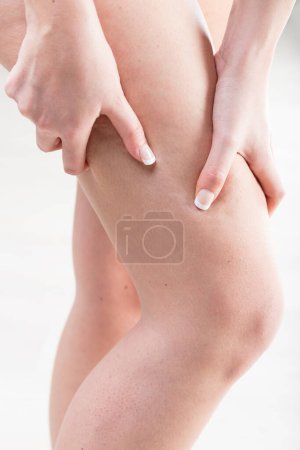 A woman is examining the texture and tonicity of her bare legs, checking for signs of cellulite or fluid retention