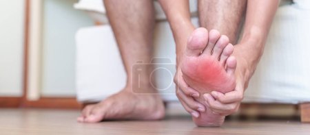 man having barefoot pain due to Plantar fasciitis and  bunion toes or blister due to wearing narrow shoes and waking or running longtime. Health and medical concept