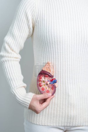 Téléchargez les photos : Woman holding Anatomical human kidney Adrenal gland model. disease of Urinary system and Stones, Cancer, world kidney day, Chronic kidney and Organ Donor Day concept - en image libre de droit