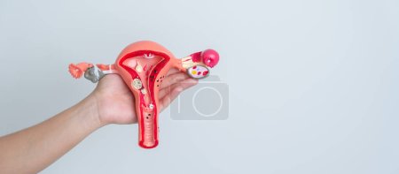 Photo for Woman holding Uterus and Ovaries model. Ovarian and Cervical cancer, Cervix disorder, Endometriosis, Hysterectomy, Uterine fibroids, Reproductive system and Pregnancy concept - Royalty Free Image