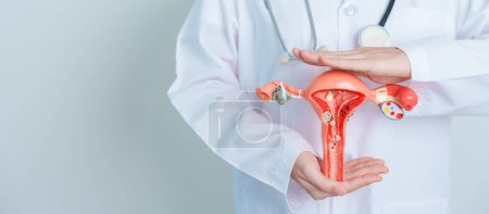 Photo for Doctor holding Uterus and Ovaries model. Ovarian and Cervical cancer, Cervix disorder, Endometriosis, Hysterectomy, Uterine fibroids, Reproductive system and Pregnancy concept - Royalty Free Image