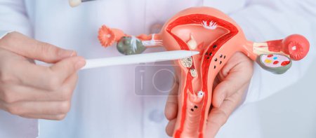 Photo for Doctor holding Uterus and Ovaries model. Ovarian and Cervical cancer, Cervix disorder, Endometriosis, Hysterectomy, Uterine fibroids, Reproductive system and Pregnancy concept - Royalty Free Image