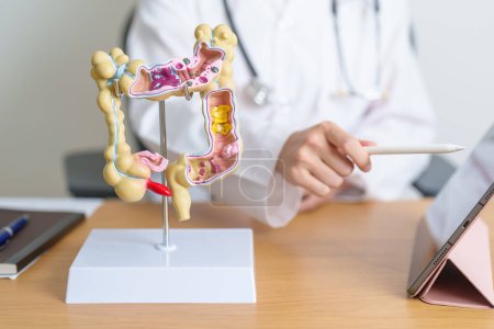 Doctor with human Colon anatomy model and tablet. Colonic disease, Large Intestine, Colorectal cancer, Ulcerative colitis, Diverticulitis, Irritable bowel syndrome and Digestive system 