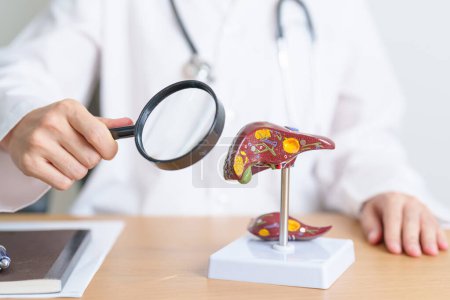 Doctor with human Liver model and Magnifying glass. Liver cancer and Tumor, Jaundice, Viral Hepatitis A, B, C, D, E, Cirrhosis, Failure, Enlarged, Hepatic Encephalopathy and Ascites Fluid in Belly
