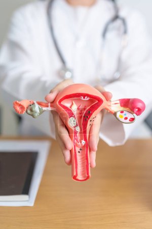 Doctor with Uterus and Ovaries anatomy model. Ovarian and Cervical cancer, Cervix disorder, Endometriosis, Hysterectomy, Uterine fibroids, Reproductive system, Pregnancy and health concept