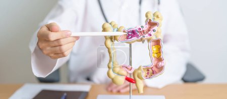 Photo for Doctor with human Colon anatomy model. Colonic disease, Large Intestine, Colorectal cancer, Ulcerative colitis, Diverticulitis, Irritable bowel syndrome, Digestive system and Health concept - Royalty Free Image