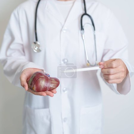 Photo for Doctor holding human Liver anatomy model. Liver cancer and Tumor, Jaundice, Viral Hepatitis A, B, C, D, E, Cirrhosis, Failure, Enlarged, Hepatic Encephalopathy, Ascites Fluid in Belly and health - Royalty Free Image