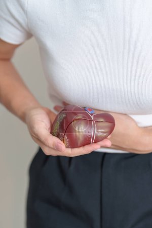 Photo for Woman holding human Liver anatomy model. Liver cancer and Tumor, Jaundice, Viral Hepatitis A, B, C, D, E, Cirrhosis, Failure, Enlarged, Hepatic Encephalopathy, Ascites Fluid in Belly and health - Royalty Free Image