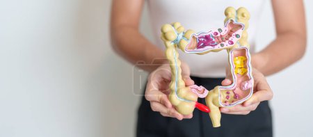 Photo for Woman holding human Colon anatomy model. Colonic disease, Large Intestine, Colorectal cancer, Ulcerative colitis, Diverticulitis, Irritable bowel syndrome, Digestive system and Health concept - Royalty Free Image