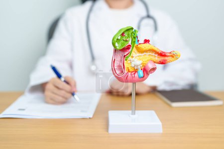 Photo for Doctor with human Pancreatitis anatomy model with Pancreas, Gallbladder, Bile Duct, Duodenum, Small intestine. Pancreatic cancer, Acute and Chronic pancreatitis,  Digestive system and Health concept - Royalty Free Image