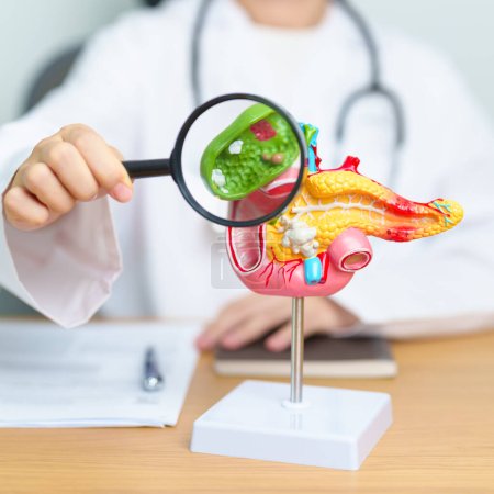 Photo for Doctor with human Pancreatitis anatomy model with Pancreas, Gallbladder, Bile Duct, Duodenum, Small intestine and magnifying glass. Pancreatic cancer, acute pancreatitis and Digestive system - Royalty Free Image