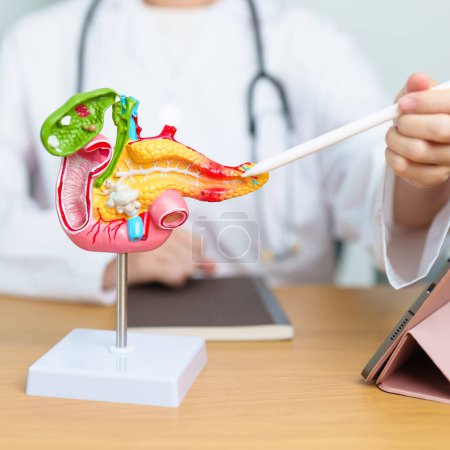 Photo for Doctor with human Pancreatitis anatomy model with Pancreas, Gallbladder, Bile Duct, Duodenum, Small intestine and tablet. Pancreatic cancer, acute pancreatitis and Digestive system - Royalty Free Image