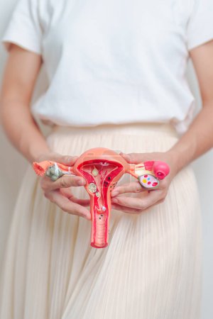 Femme tenant l'utérus et les ovaires modèle. Cancer de l'ovaire et du col utérin, endométriose, hystérectomie, fibromes utérins, reproduction, menstruation, estomac, grossesse et maladies sexuellement transmissibles
