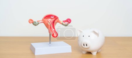 Photo for Uterus and Ovaries model with Piggy Bank for Ovarian and Cervical cancer, Cervix disorder, Endometriosis, Hysterectomy, Uterine, Reproductive, Pregnancy, Donation and Charity concept - Royalty Free Image