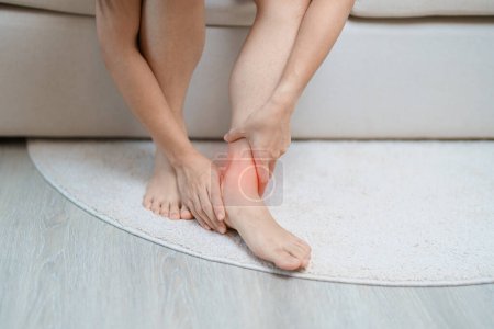Foto de Mujer que tiene dolor en las piernas debido a esguinces de tobillo o tendonitis de Aquiles y dolor en las férulas de la espinilla. lesiones, salud y concepto médico - Imagen libre de derechos