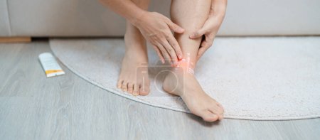 Arthritis und Muskelschmerzlinderung Creme-Konzept. Frauen, die Beinschmerzen aufgrund von Verstauchungen des Sprunggelenks oder Achillessehnenentzündungen und Schienbeinschmerzen haben. Verletzungen, Gesundheit und medizinisches Konzept