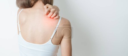 woman itching and scratching itchy back. Sensitive Skin Allergic reaction to insect bite, food, drug dermatitis. Dermatology, Leprosy, Systemic lupus erythematosus, Allergy symptoms and rash Eczema