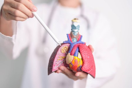 Ärzte weisen Raucher-Lungen-Anatomie auf Krankheit hin. Lungenkrebs, Asthma, chronisch obstruktive Lungen- oder COPD, Bronchitis, Emphysem, Mukoviszidose, Bronchiektasen, Lungenentzündung und der Welt-Lungentag im September