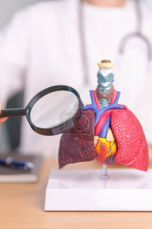 Doctor con Ahumador Anatomía pulmonar con lupa. Cáncer de pulmón, asma, enfermedad pulmonar obstructiva crónica o EPOC, bronquitis, enfisema, fibrosis quística, bronquiectasias, neumonía y mundo Día del pulmón