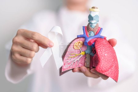 November Lung Cancer Awareness month. Doctor with Smoker Lung anatomy model and White ribbon in hospital. Healthcare and World Cancer day concept