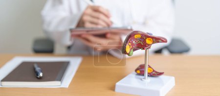Photo for Doctor with human Liver anatomy model. Liver cancer and Tumor, Jaundice, Viral Hepatitis A, B, C, D, E, Cirrhosis, Failure, Enlarged, Hepatic Encephalopathy, Ascites Fluid in Belly and health concept - Royalty Free Image