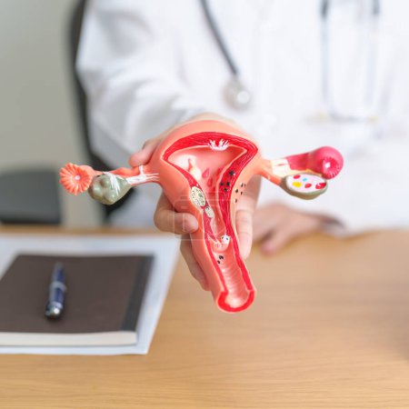 Doctor con modelo de anatomía de útero y ovarios. Cáncer de ovario y cuello uterino, Trastorno del cuello uterino, Endometriosis, Histerectomía, Fibromas uterinos, Sistema reproductivo, Embarazo y concepto de salud