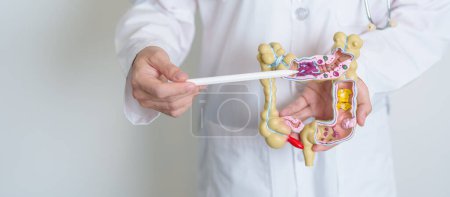 Doctor holding human Colon anatomy model. Colonic disease, Large Intestine, Colorectal cancer, Ulcerative colitis, Diverticulitis, Irritable bowel syndrome, Digestive system and Health concept