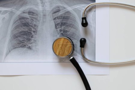 Foto de Imagen fluorográfica de los pulmones sobre papel y estetoscopio, pulmones sanos de un hombre para un examen rutinario - Imagen libre de derechos