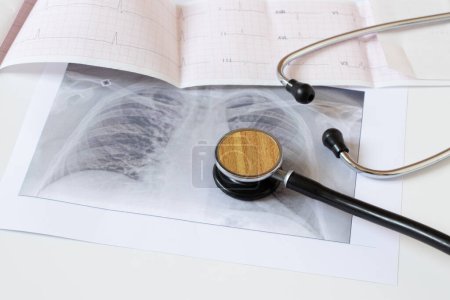 Fluorographische Aufnahme der Lungen auf Papier und ein Kardiogramm und ein Stethoskop auf weißem Hintergrund, gesunde menschliche Lungen für Routineuntersuchungen, Gesundheit