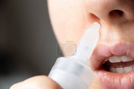 Girl and nose drops close-up, cold and treatment of runny nose, dripping nose